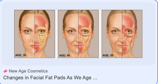 Why is it important to address fat pads in the face as we age? And how to fix this aging issue.