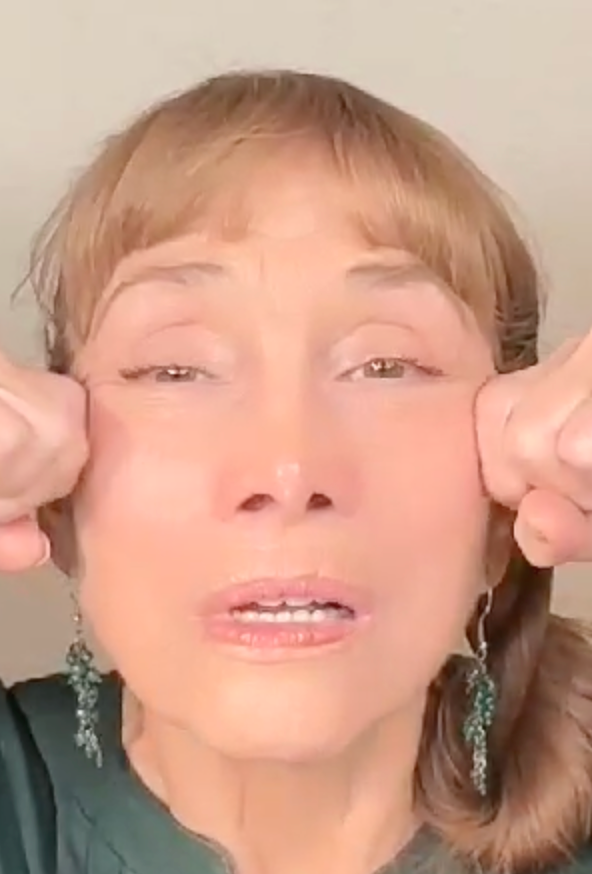 Naso/labial Fold Line Eliminator, Lifting the Bottom of the Face & Firming the Double Chin